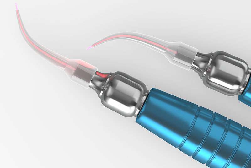 laser tool for dental procedure