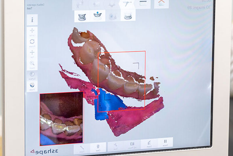 digital image of patient mouth for dental procedure